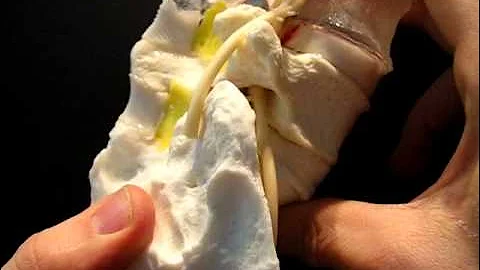 Multilevel Dynamic Spinal Model (sacrum-L5-L4) by Dynamic Disc Designs Corp.