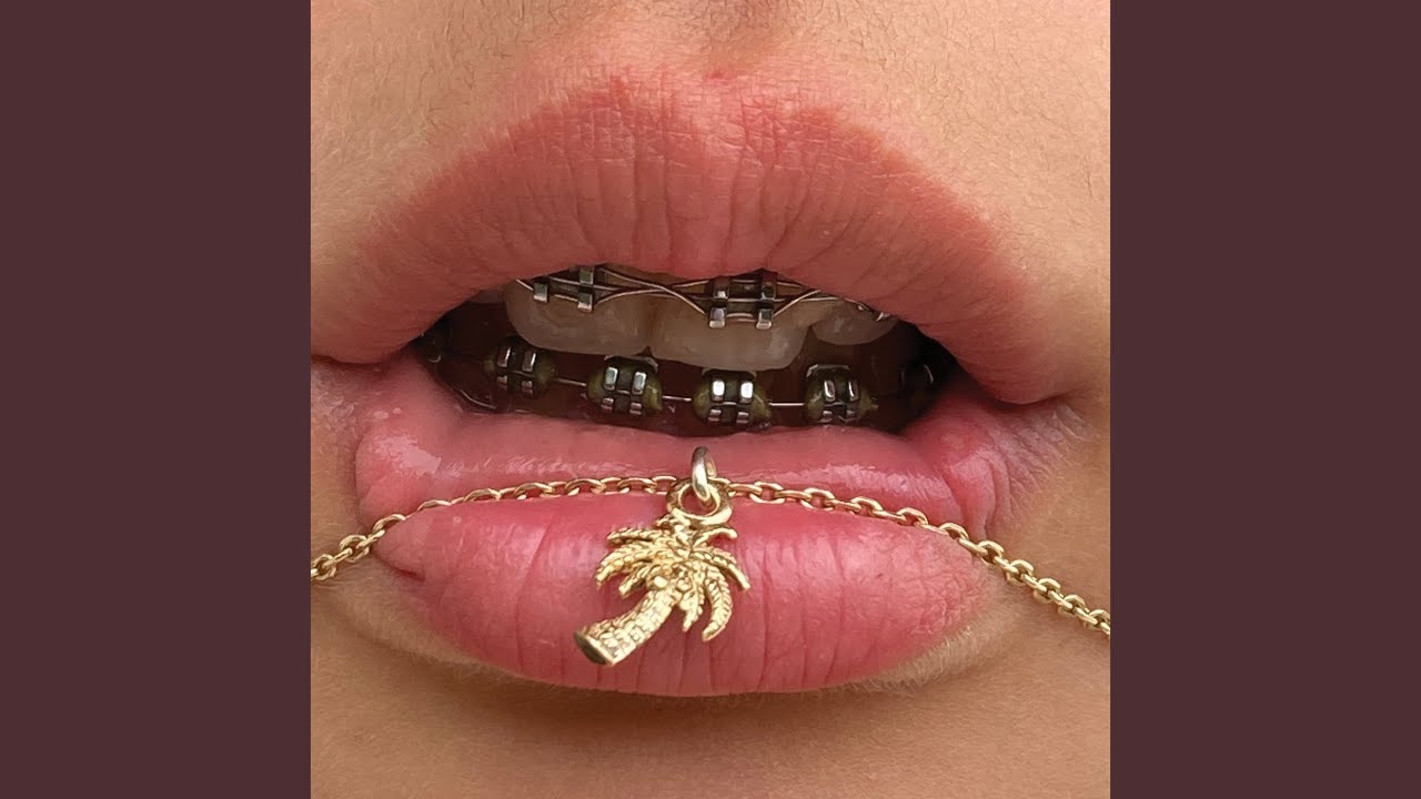 Watch Midas on YouTube Watch Midas on YouTube