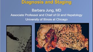 Gastric Cancer Etiology, Genetics, Diagnosis and Staging
