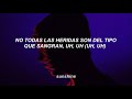 Unstable - Justin Bieber ft.The Kid LAROI || Subtitulado Español