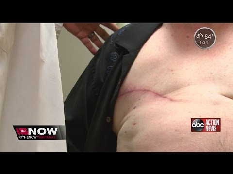 Men facing breast cancer opting for mastectomies