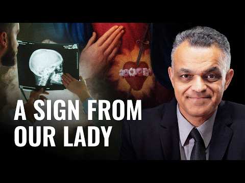 He Woke from His Coma Yelling ‘Her Immaculate Heart will Triumph’