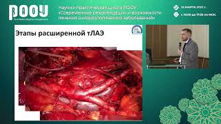 видео: Лимфодиссекция при РМП: значение, практические аспекты. Головащенко М. П. — Конференция в г. Грозный картинка: Лимфодиссекция при РМП: значение, практические аспекты. Головащенко М. П. — Конференция в г. Грозный