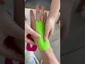 Use Kinesiology Tape To Relieve Carpal Tunnel Syndrome Kinesiologytape Carpaltunnelsyndrome 