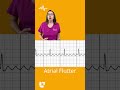 Difference between atrial fibrillation and atrial flutter F