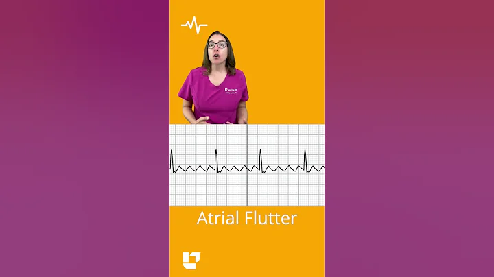 Difference between atrial fibrillation and atrial flutter F