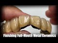 Finish Full-Mouth Metal Ceramics With Me