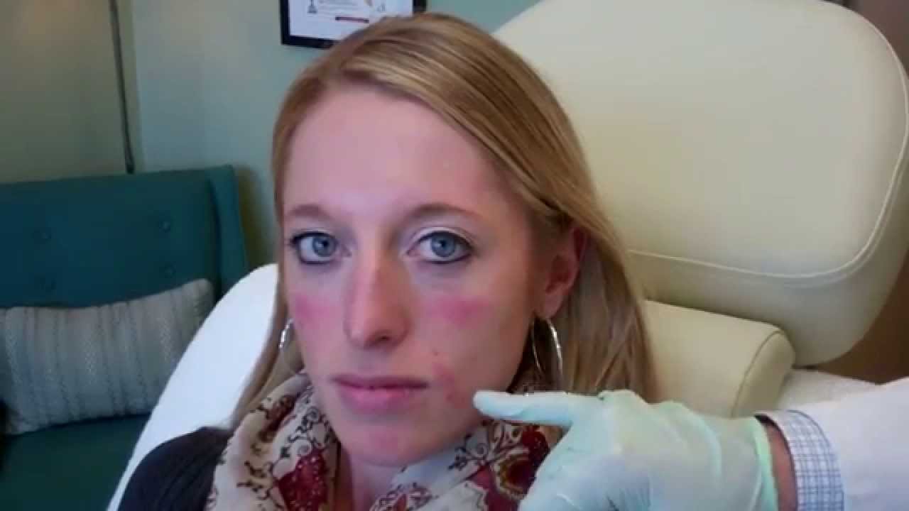 Smooth your parenthesis lines with Dr Janowski - YouTube