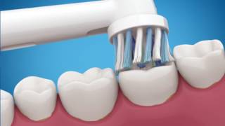 Introducing Oral-B PRO 5000