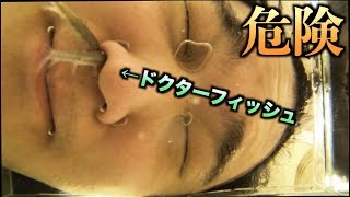 【事故】ドクターフィッシュの水槽に顔を入れた結果wwwww