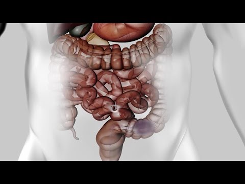 Vidéo: La Digestion Saine D'un écolier