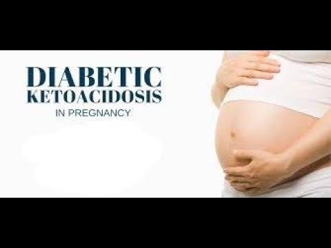 Diabetic Ketoacidosis DKA in Pregnancy;  Why Pregnancy Increases DKA Risk, Treatment