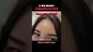 긴 말이 필요없는 주름보톡스의 중요성