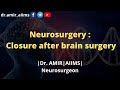 Neurosurgery  closure after brain surgery  dr amir aiims