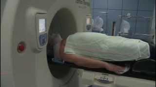 Having Radiotherapy for Brain Cancer