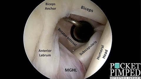 The Basics of Shoulder Arthroscopy
