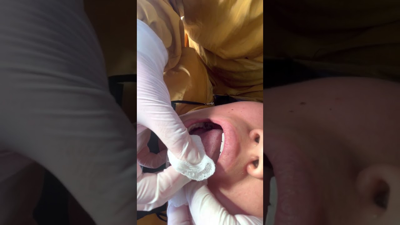 Exploración Cavidad Oral