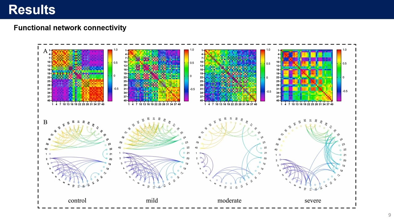 [저널미팅]EEG-Based Assessment of Stroke Severity and Exploration of Biomarkers for Motor Rehabilitation