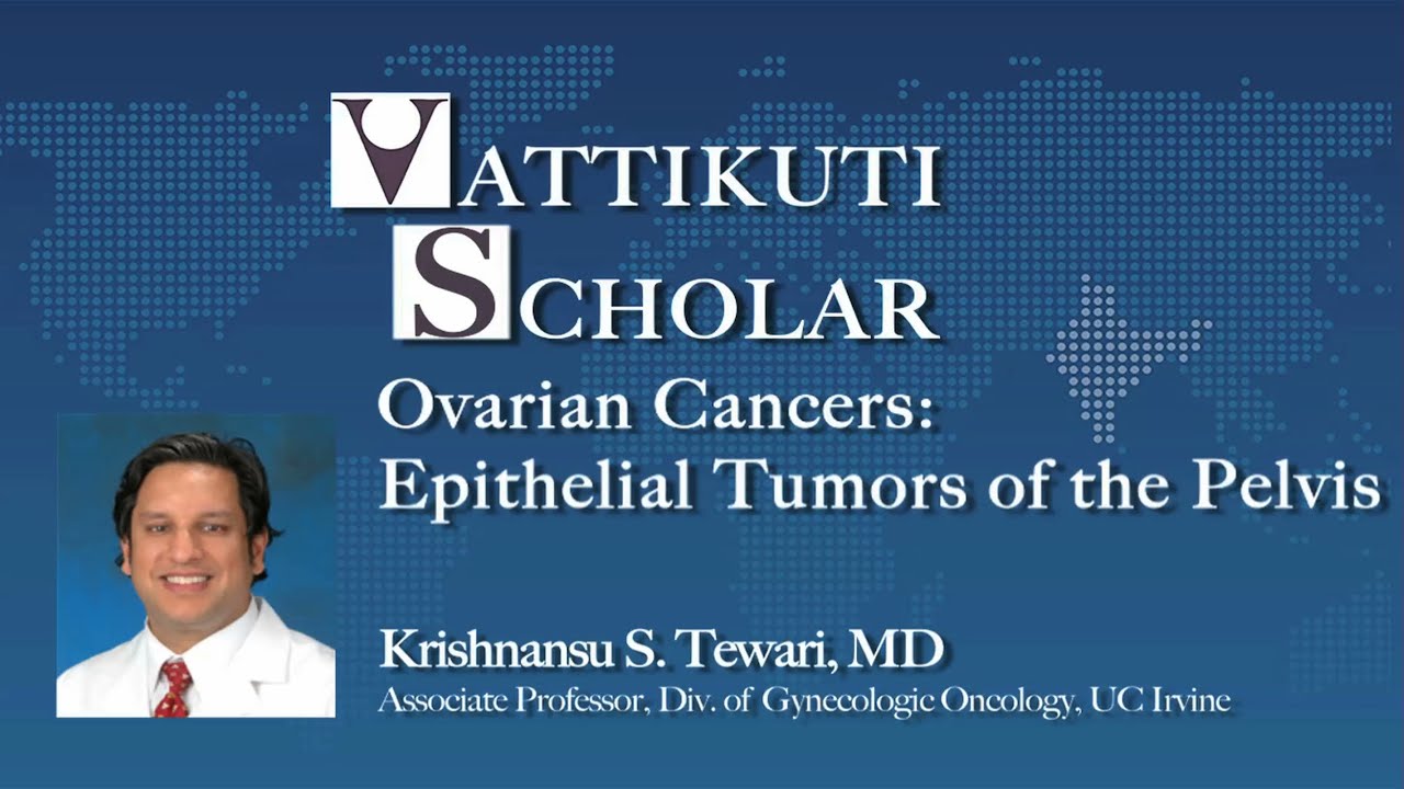 Dr. Krishnansu Tewari: Ovarian Cancers- Epithelial Tumors of the Pelvis