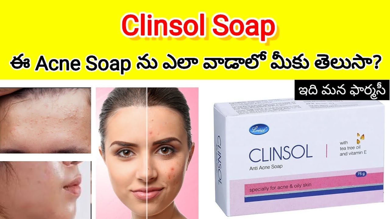 clinsol soap in telugu | clinsol soap review in telugu