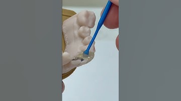 Holding Adjacent teeth!