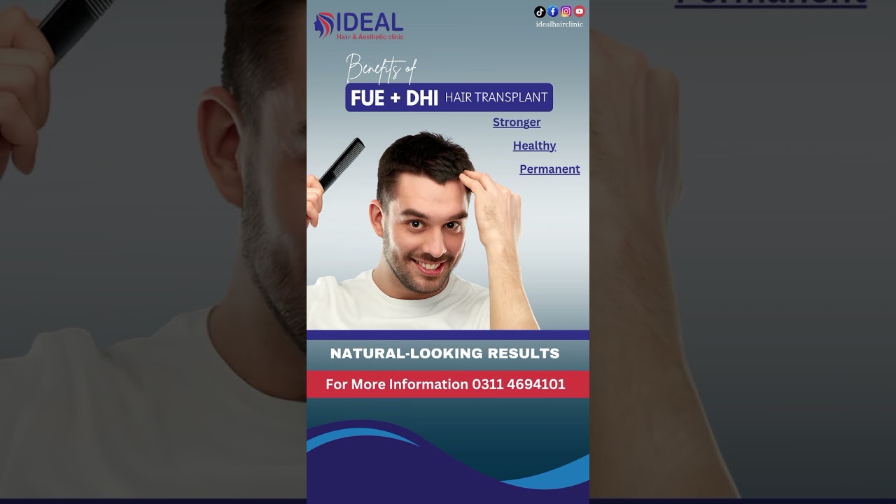 ✨ “FUE + DHI Hair Transplant | The Future of Hair Restoration” ✨