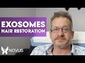How Do Exosomes For Hair Restoration Work? | Full Hair Treatment Explanation | Novus