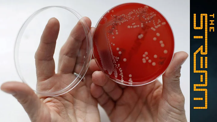 Is your doctor killing you? Antibiotics and the rise of the superbug - The Stream - DayDayNews