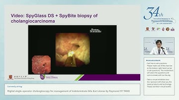 DSOC for management of indeterminate biliary strictures and difficult BD stones by Raymond SY TANG