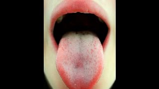 Sweet taste of the mouth - causes in a new vision by Dr / Ghorab