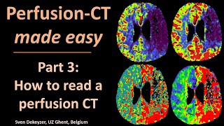 Perfusion CT made easy - part 3  - How to read perfusion CT?