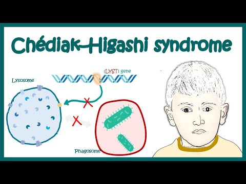 chediak higashi syndrome | What are the symptoms of Chediak Higashi Syndrome? | pathophysiology