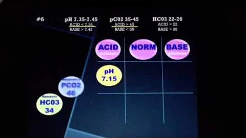 ABG vertical Tic Tac Toe