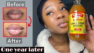 HOW I LIGHTENED MY LIPS QUICK WITH ONE PRODUCT - Updated‼️(Permanently)