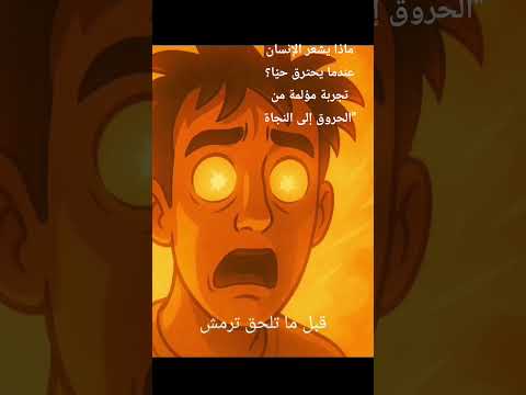 ماذا يشعر الإنسان عندما يحترق حي ا تجربة مؤلمة من الحروق إلى النجاة العقل قصص تجربة قاسية