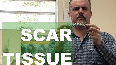 Chiropractor Explains Scar Tissue: causes, formations, restoration