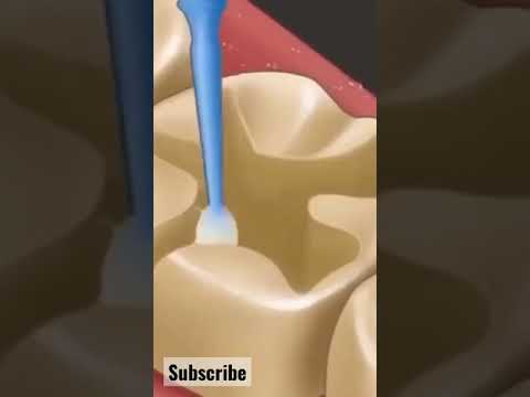 Video: Si funksionojnë zbardhuesit e dhëmbëve led?
