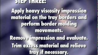 Massad Tray Impression Review