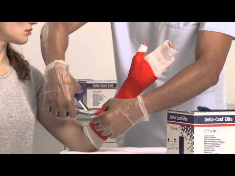 Delta-Cast Soft Thumb Spica Cast Application