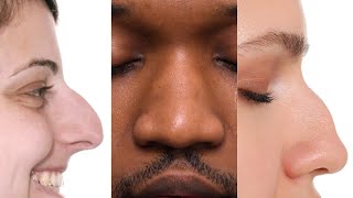 Why do different ethnicities have different nose shapes?