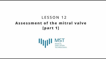 MST Masterclass - Lesson 12 - Assessment of the mitral valve (part 1)
