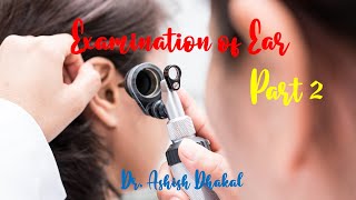 Examination of Ear ~~ How to examine EAR case (Otology ENT exam) - PART 2 || for MBBS, PG students