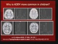 Pediatric ADEM and Transverse Myelitis