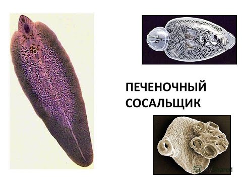 Печеночный сосальщик Fasciola hepatica