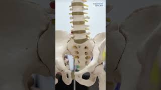 Back Pain & Leg Pain? It Could Be Sciatica | Doctor Explains the Real Cause