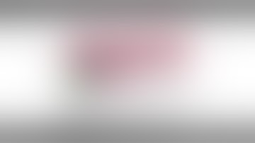 Buccal bone loss correction with implant placement using OSSIX® Volumax