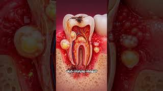 الألم اللي بيجي ويختفي فجأة؟ هاد أخطر وجع للأسنان… ما تفكر إنه راح! تعال شوف ليش
