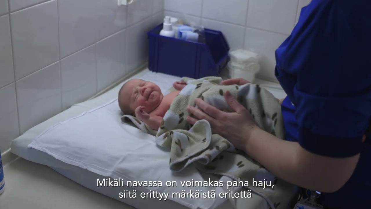 5.6 Synnytyksen jälkeen: Vauvan navan hoito