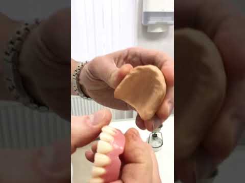 Кипятим зубной протез!