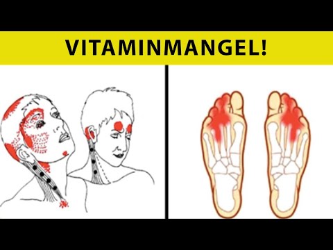 Video: Opdelte Læber: Behandling, årsager, Vitaminmangel Og Infektion